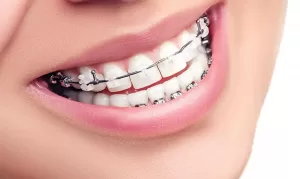 izmir ortodonti